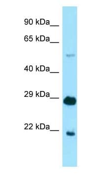 IKZF1 / IKAROS Antibody (aa43-92)