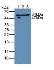DLD / Diaphorase / E3 Antibody (aa238-466)