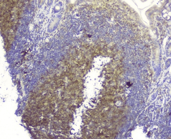 SQSTM1 Antibody