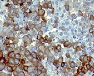 NGFR / CD271 / TNR16 Antibody (clone NTR/912)