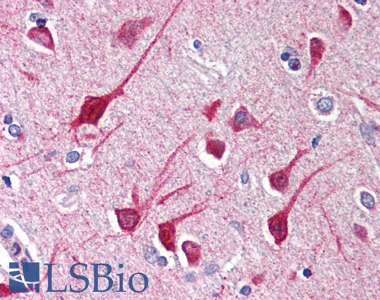 IHC-plus™ Polyclonal Rabbit anti-Human NALP1 / NLRP1 Antibody (IHC, IF, WB)