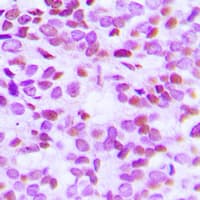 Histone H2B Antibody (Acetyl-Lys15)