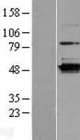 C16orf58 Protein (Over-Expression Lysate Myc-DDK (Flag))