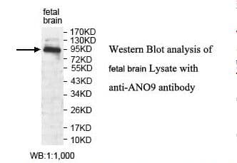 Polyclonal Rabbit anti-Human ANO9 / TMEM16J Antibody (aa81-224, IHC, WB)