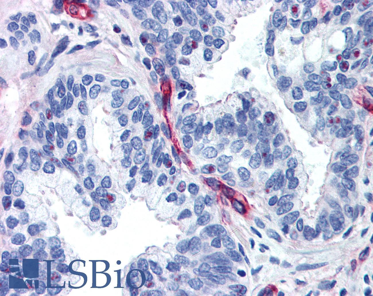 PathPlus™ NES / Nestin Antibody (aa1464-1614)
