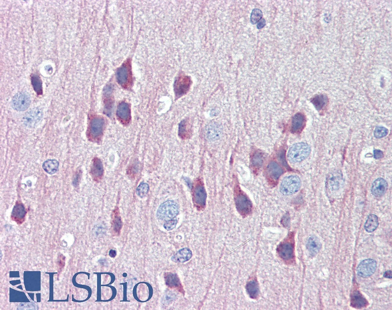 Polyclonal Rabbit anti-Human LAMP1 / CD107a Antibody (IHC, IF, WB)