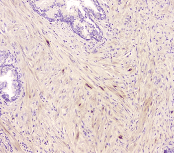 CCR10 / GPR2 Antibody