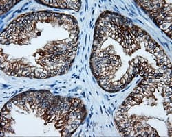 SRR / Serine Racemase Antibody (clone OTI2E3)