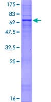 Human FA2H / FAAH Protein (Recombinant GST)