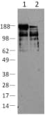 PathPlus™ NES / Nestin Antibody (clone 10C2)