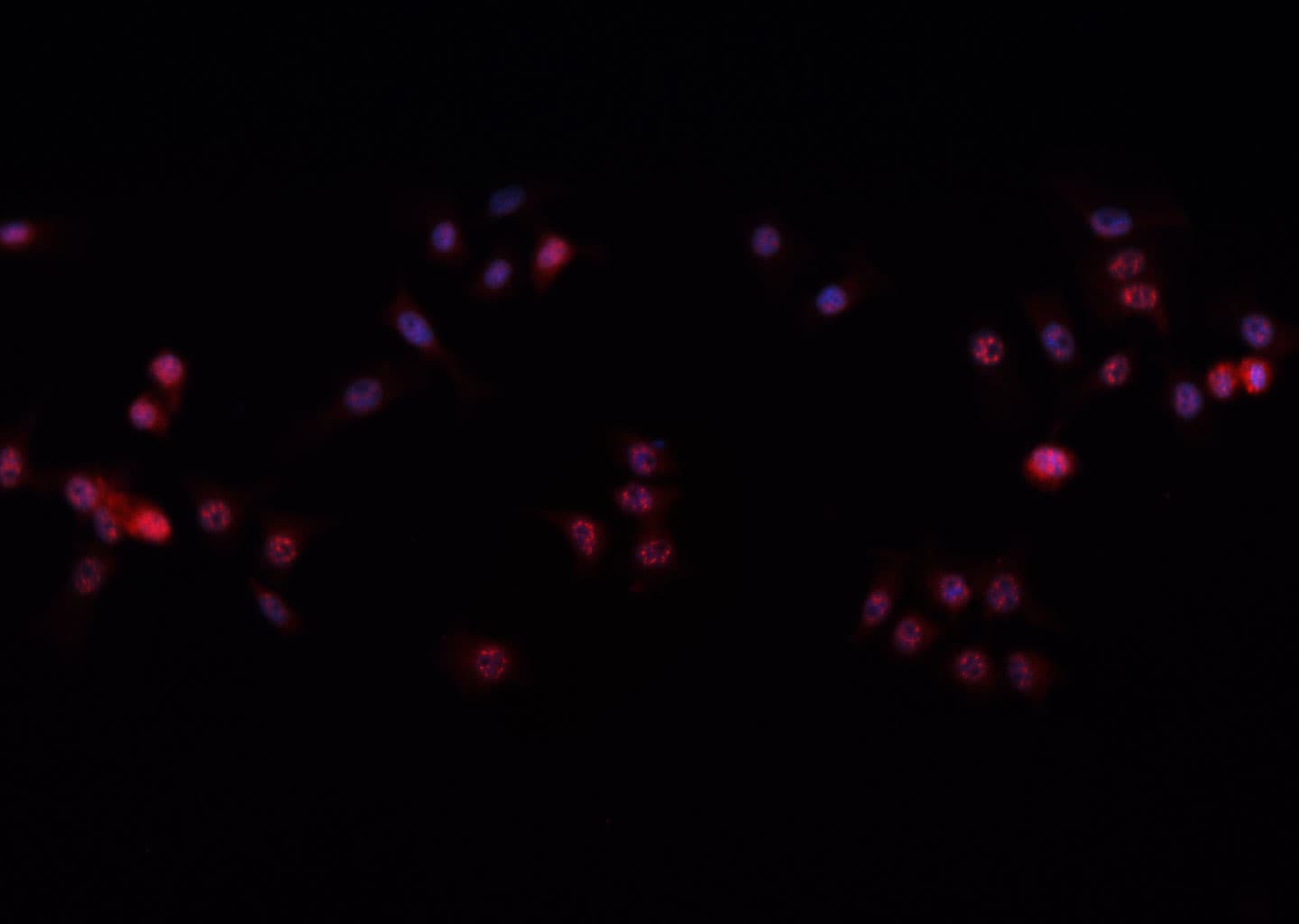 Polyclonal Rabbit anti-Human TP63 / p63 Antibody (IF, WB)