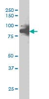 RAD17 Antibody (clone 2G12)