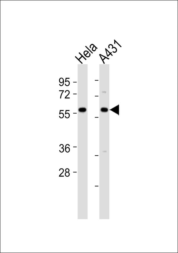 CCT8 Antibody