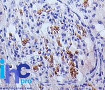 TSLP Antibody (clone 55N2D4)