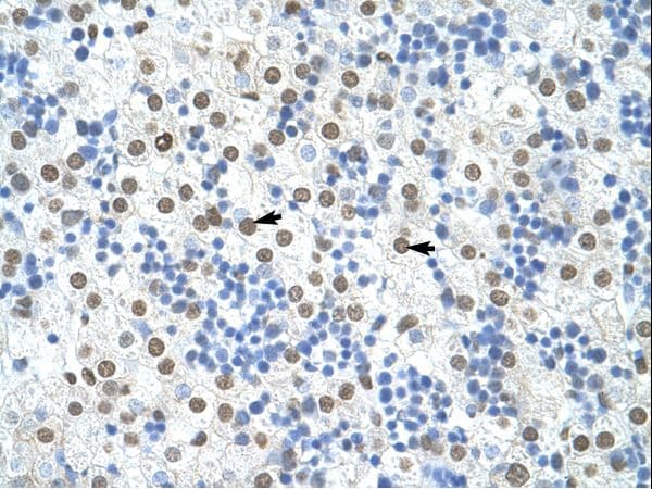 HNRPA1 / HnRNP A1 Antibody (N-Terminus)