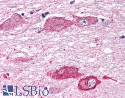 PathPlus™ Polyclonal Rabbit anti-Human GRM7 / MGLUR7 Antibody (N-Terminus, IHC, WB)