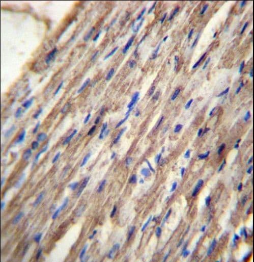 ACSM6 Antibody (aa433-460)