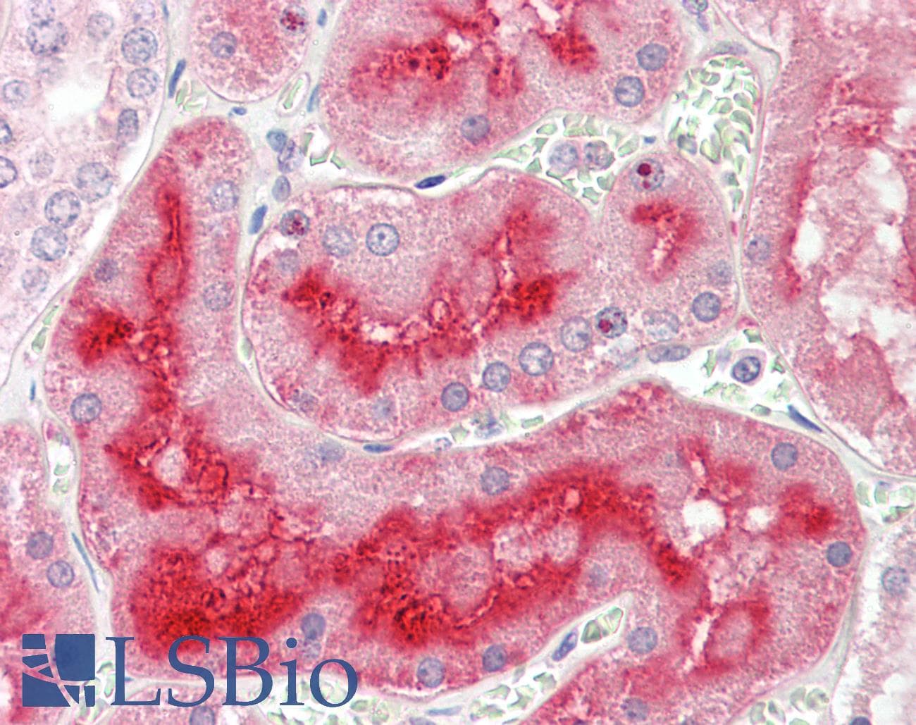 IHC-plus™ ALPL / Alkaline Phosphatase Antibody (aa18-502, clone 2F4)