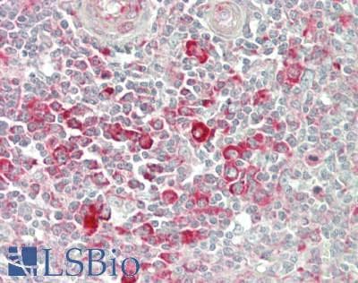 IHC-plus™ EF1G / EEF1G Antibody (aa400-C-term)