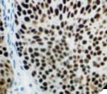 MCM2 Antibody (clone RBT-MCM2)