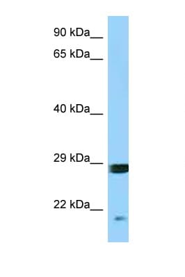 Polyclonal Rabbit anti-Human SNX12 Antibody (aa68-117, WB)