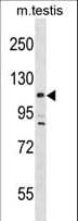 Polyclonal Rabbit anti-Mouse LATS2 Antibody (aa1000-1027, WB)