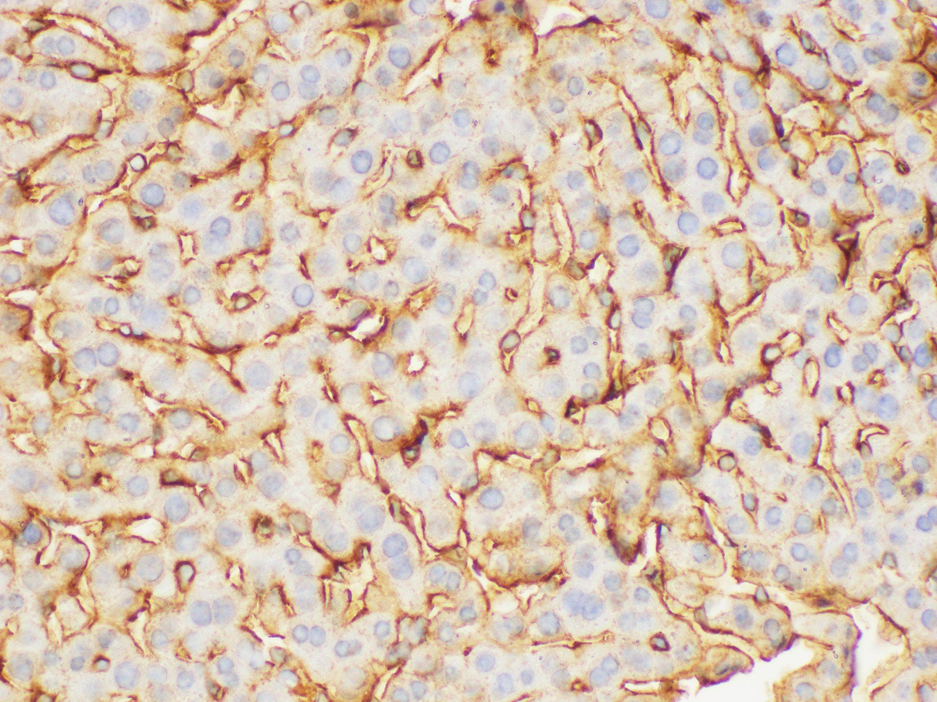 FGB / Fibrinogen Beta Chain Antibody