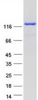 Human RAB3GAP1 Protein (Recombinant Myc-DDK (Flag))