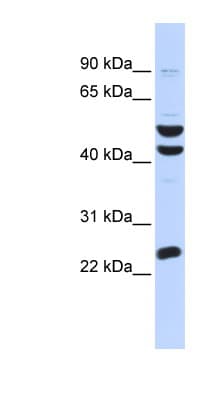 ZNF200 Antibody (aa324-373)