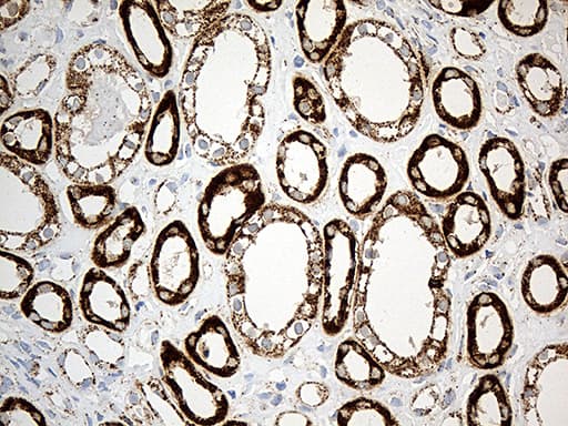 MCAD / ACADM Antibody (clone OTI2G7)