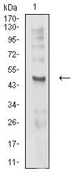CHRND Antibody (clone 1H1F9)