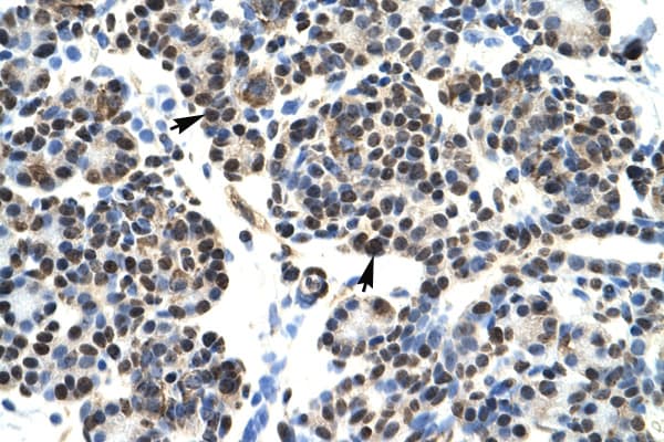 HOXB5 Antibody (N-Terminus)