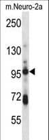 SMURF1 Antibody (aa352-381)