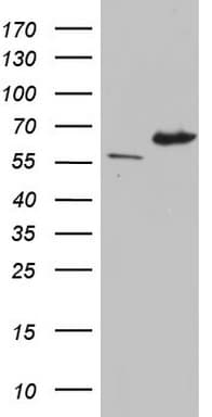 Monoclonal Mouse anti-Human IKZF3 / AIOLOS Antibody (clone OTI5E2, aa1-301, IHC, WB)
