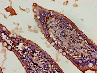 Polyclonal Rabbit anti-Human FBXW2 Antibody