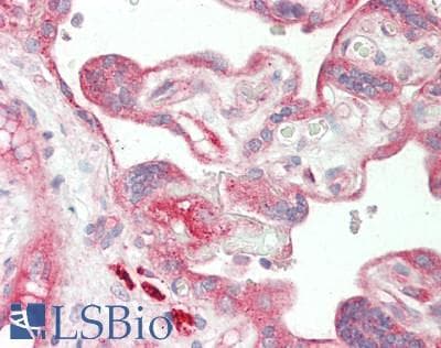 IHC-plus™ ITGB1 / Integrin Beta 1 / CD29 Antibody (aa746-795)