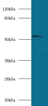 CHRNA1 Antibody