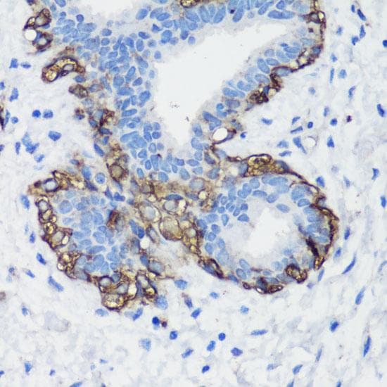 FLNA / Filamin A Antibody