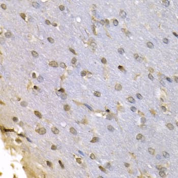 HNRNPF / hnRNP F Antibody