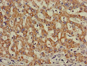 INSR / Insulin Receptor Antibody