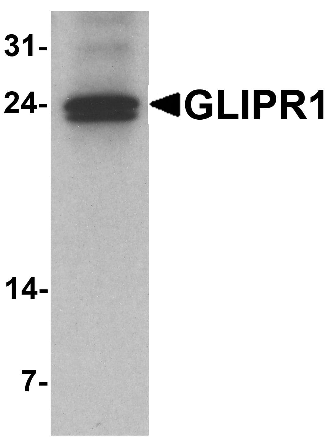 GLIPR1 / GLIPR Antibody