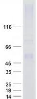 Human PH / PAH Protein (Recombinant Myc-DDK (Flag))