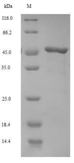 Moloney Murine Leukemia Virus gag / Pr65 Protein (Recombinant GST, N-terminus)