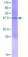 Human ZMAT5 Protein (Recombinant GST)