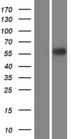 SCARB1 / SR-BI Protein (Over-Expression Lysate Myc-DDK (Flag))