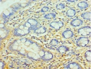 CFH / Complement Factor H Antibody (aa20-270)