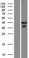 NR1I3 / CAR Protein (Over-Expression Lysate Myc-DDK (Flag))