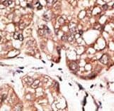 Polyclonal Rabbit anti-Human ATG4D Antibody (aa220-249, IHC, WB)