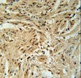 Polyclonal Rabbit anti-Human BLOC1S2 Antibody (aa14-40, IHC, WB)