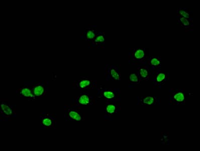 Polyclonal Rabbit anti-Human HIST1H3A Antibody (IHC, IF, WB)